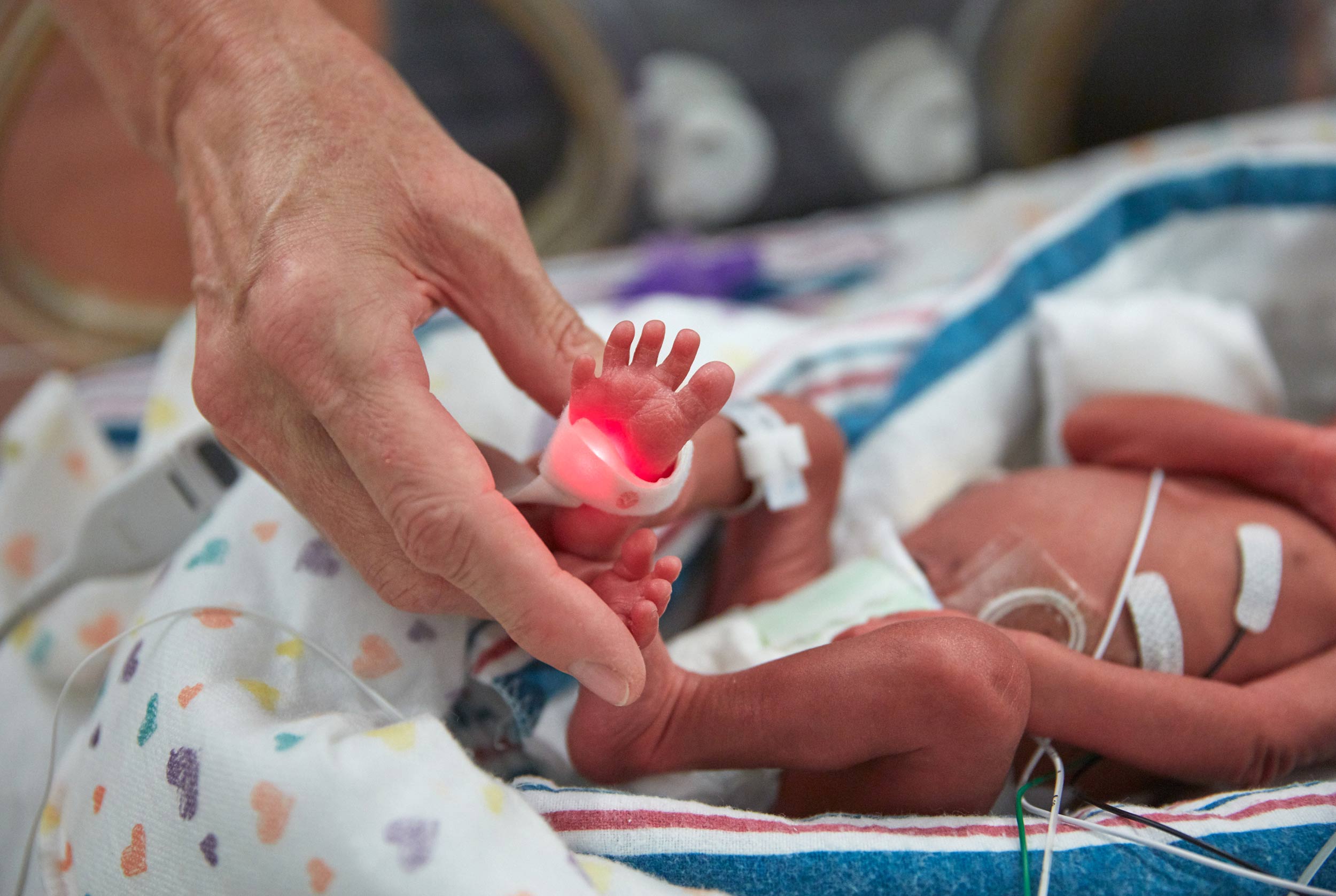 A Nurse Tends to a premature infant in the NICU